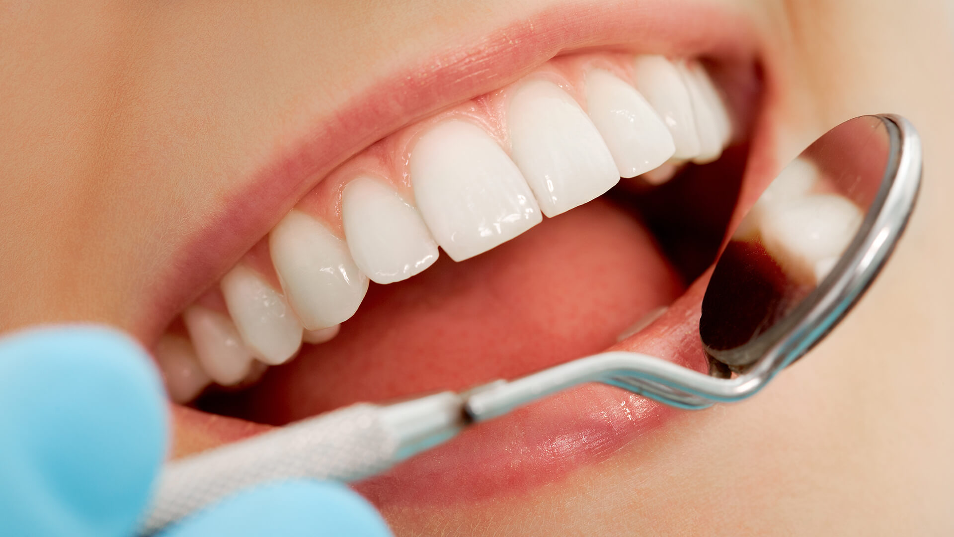 gastro-blogs_acid-reflux-teeth